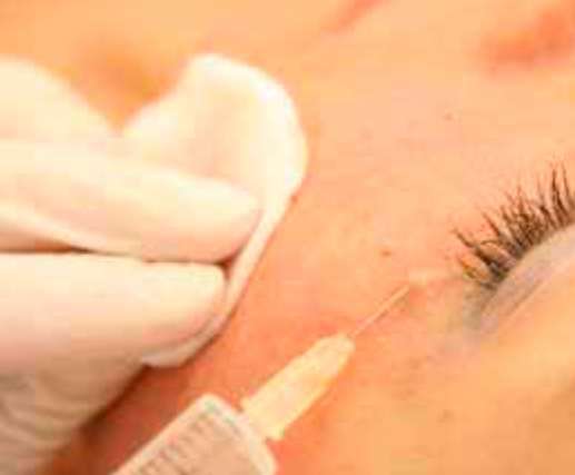 мезотерапия