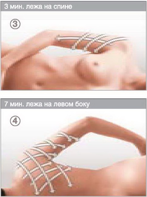 Лифтинг рук - LPG-массаж