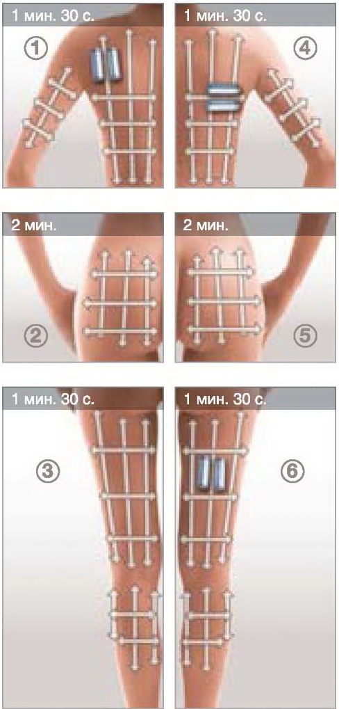 SPA-процедура