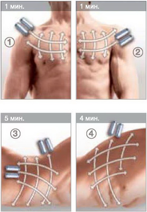 Эндермо-Моделирование - массаж передней поверхности тела