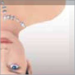 LPG - разглаживание морщин на области декольте