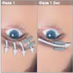 LPG - лифтинг век