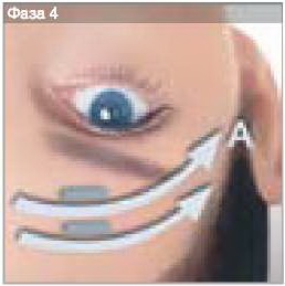 LPG - дренаж для выведения токсинов - фаза 4