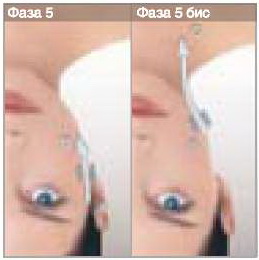 LPG - дренаж для выведения токсинов - фаза 3