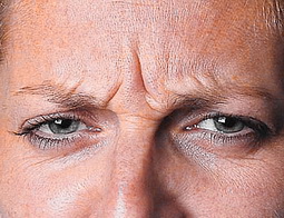 мимические морщины