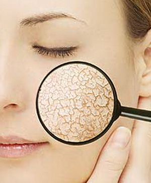 Сухая кожа лица