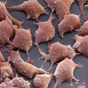 Фибробласты